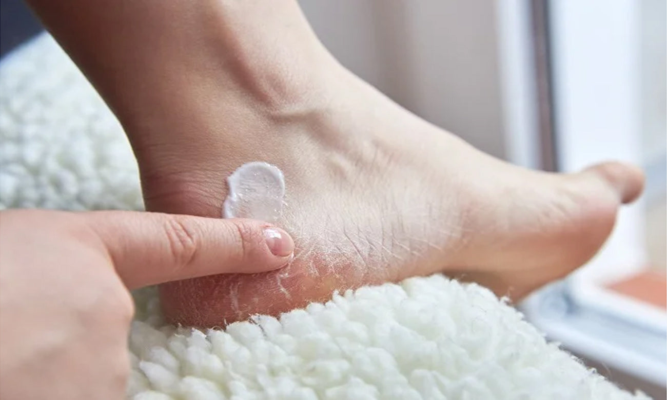 FOOT CARE